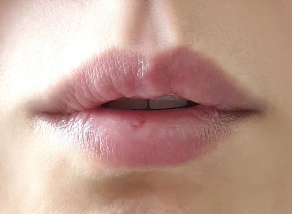 랩노 4SP 세이프 립밤